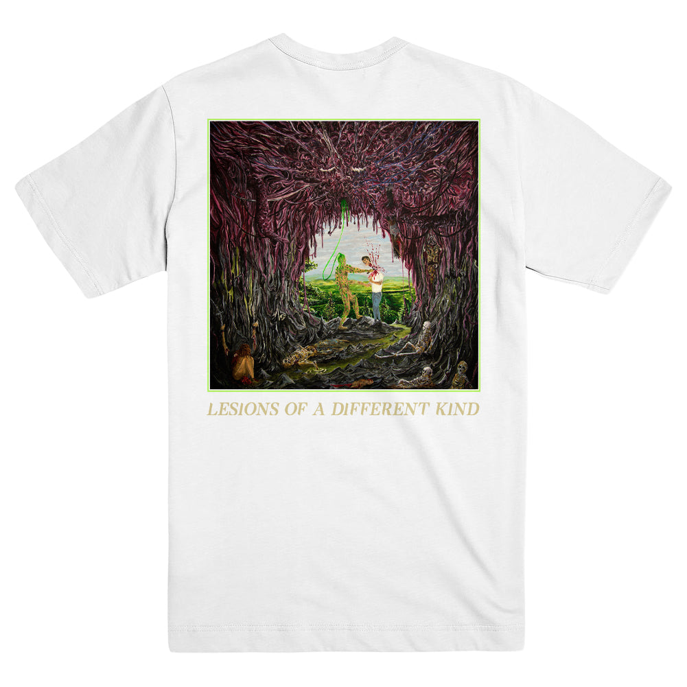Undeath Merch Lesions Of A Different Kind Shirt Undeath Shirt Father'S Day Gifts For Husband-1